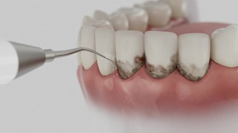 Reliable Dental Implants contractor in Aledo, TX by Smile Center Dentistry